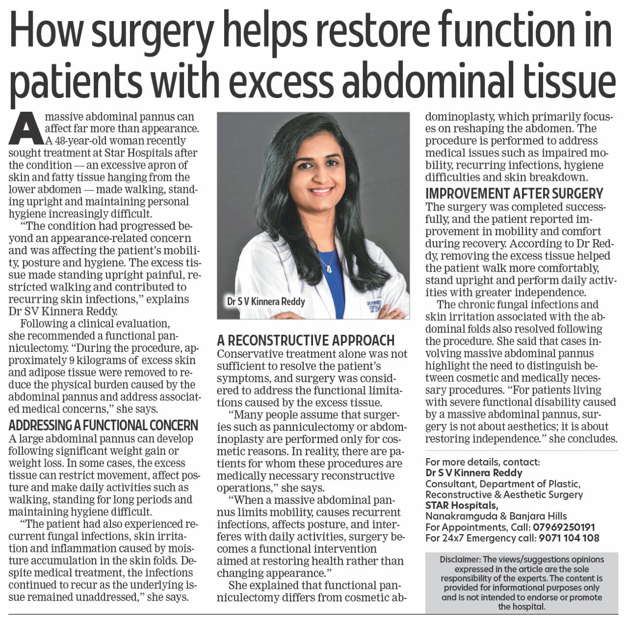 Panniculectomy Surgery