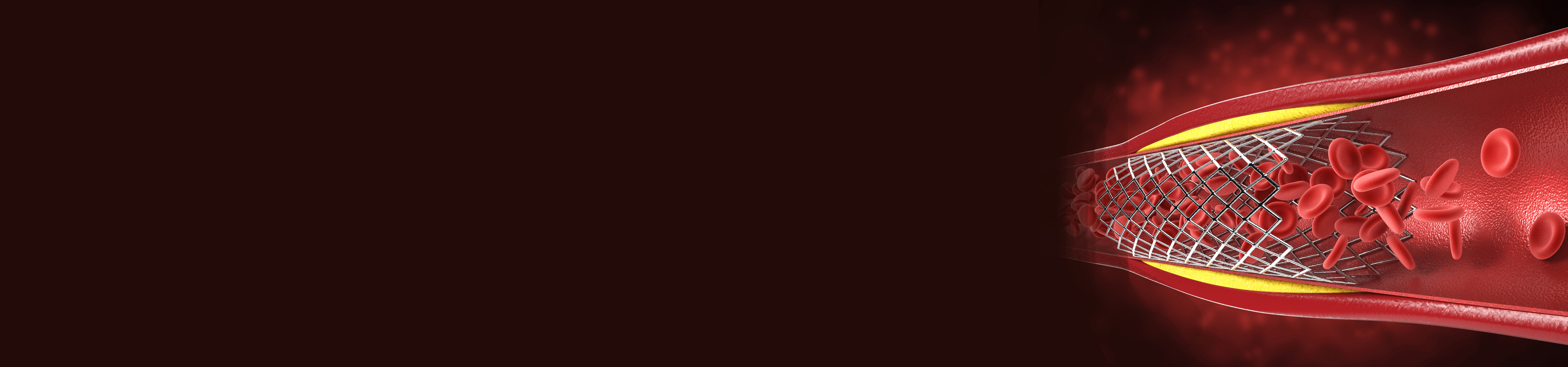 Best Vascular Surgery Hospital in Hyderabad