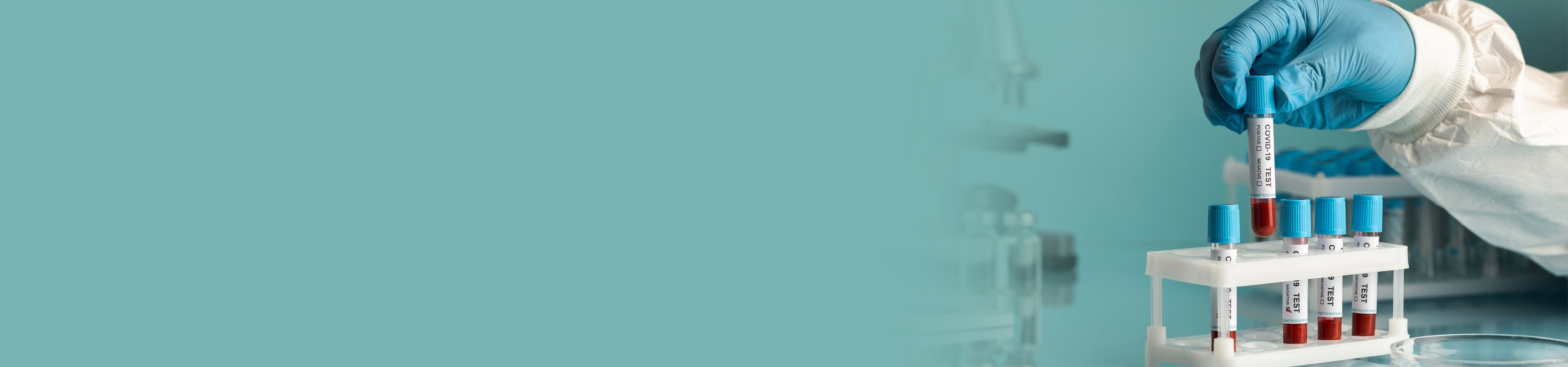 Best Pathology Lab Service in Hyderabad