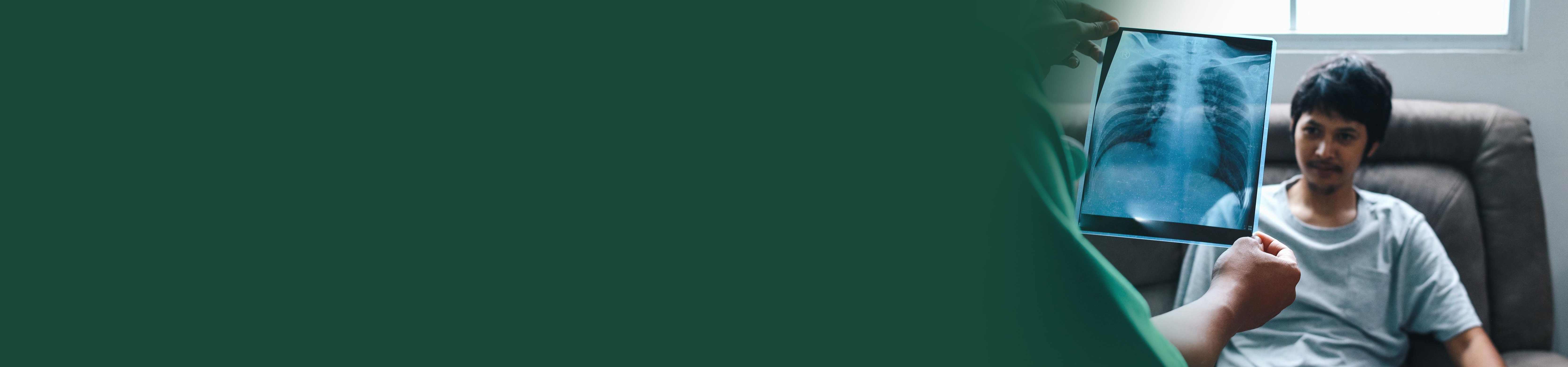 Top Pulmonologists in Banjara Hills