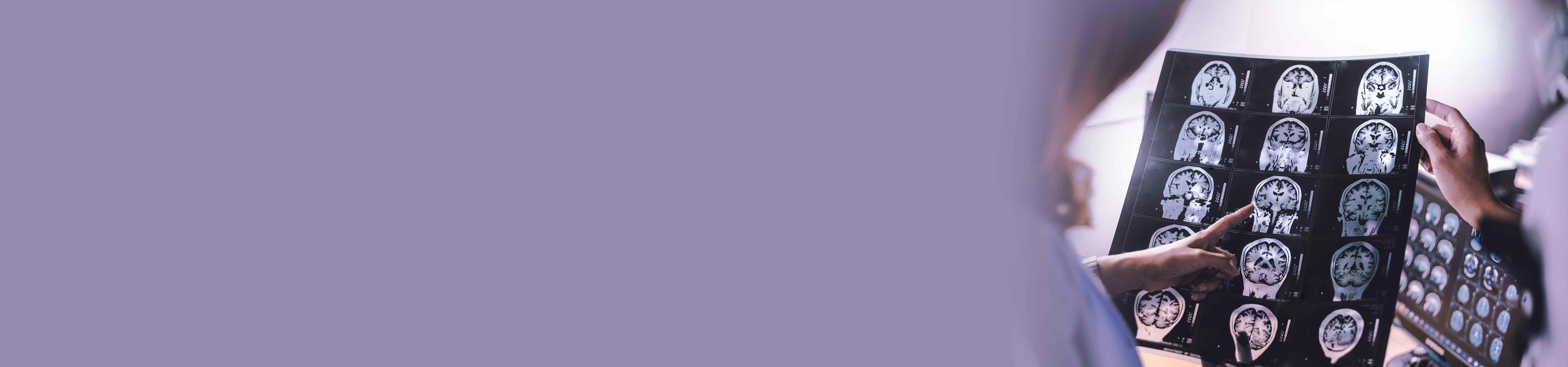 Top Neurologists in Banjara Hills