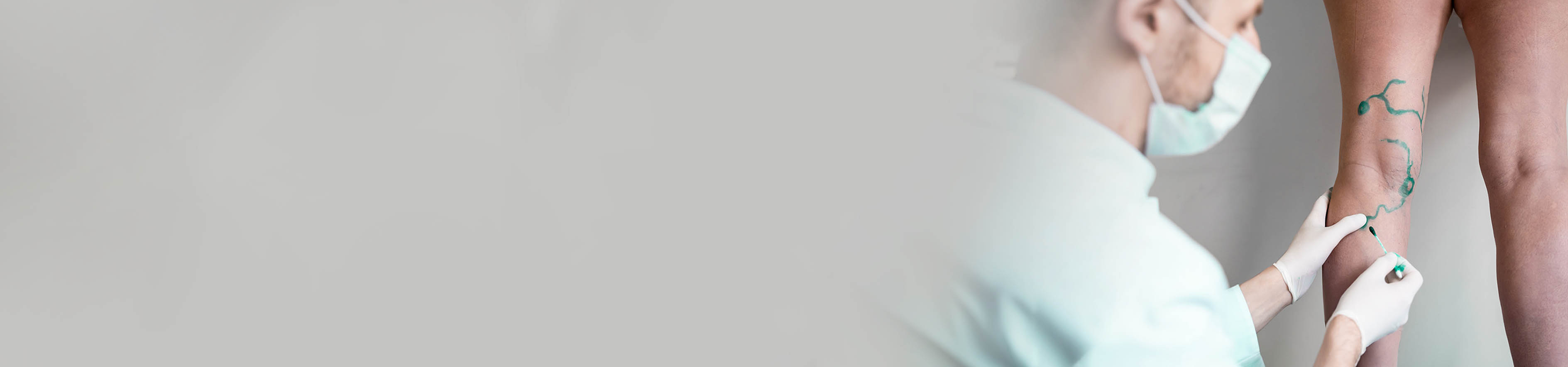 Top Vascular Surgeons in Banjara Hills