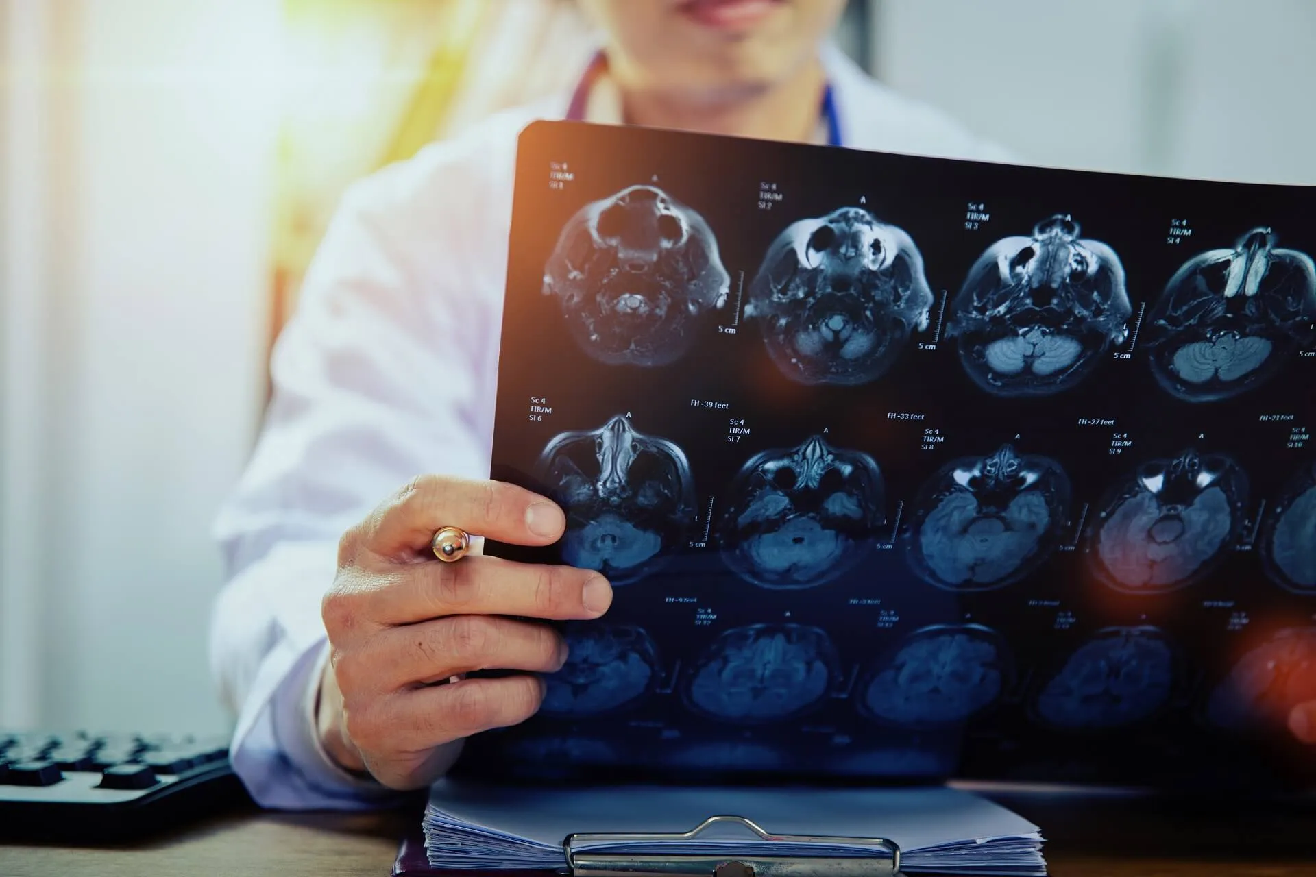 Best Neurologist In Hyderabad | Best Neurologist Near Me | STAR Hospitals