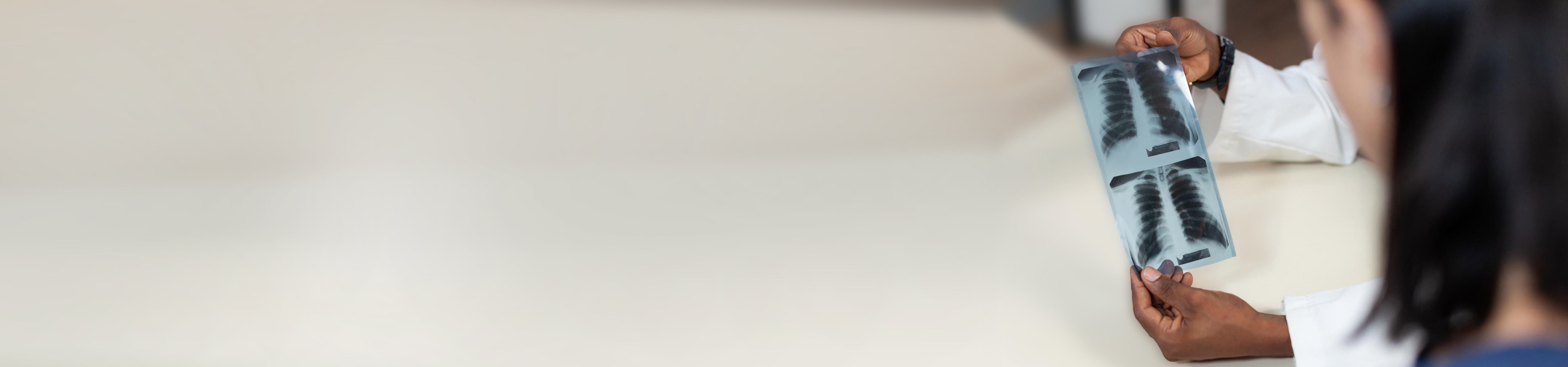 Top Interventional Pulmonologists in Banjara Hills