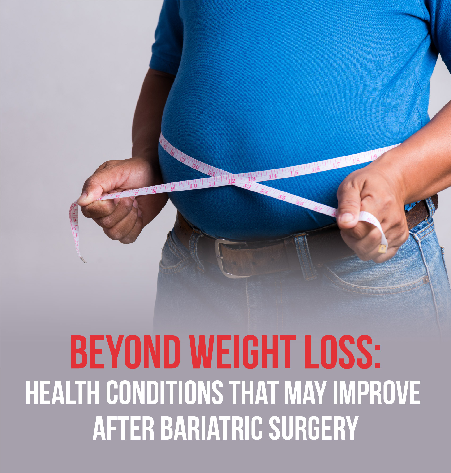 Health Benefits of Bariatric Surgery Beyond Weight Loss
